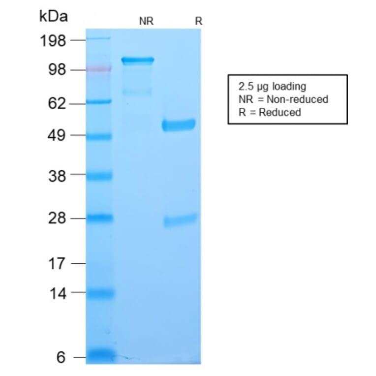 SDS-PAGE - Anti-Bcl-6 Antibody [BCL6/2497R] - BSA and Azide free (A253089) - Antibodies.com