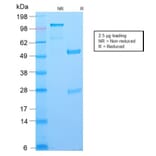 SDS-PAGE - Anti-Bcl-6 Antibody [BCL6/2497R] - BSA and Azide free (A253089) - Antibodies.com