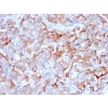 Immunohistochemistry - Anti-BCMA Antibody [BCMA/2366] - BSA and Azide free (A253090) - Antibodies.com