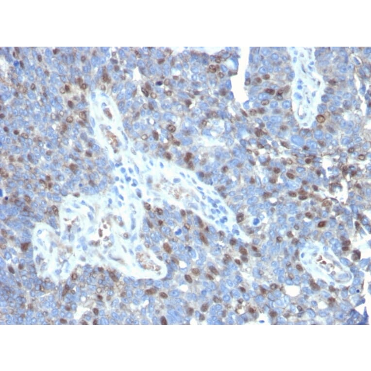 Immunohistochemistry - Anti-ROR gamma Antibody [RORC/2941] - BSA and Azide free (A253091) - Antibodies.com