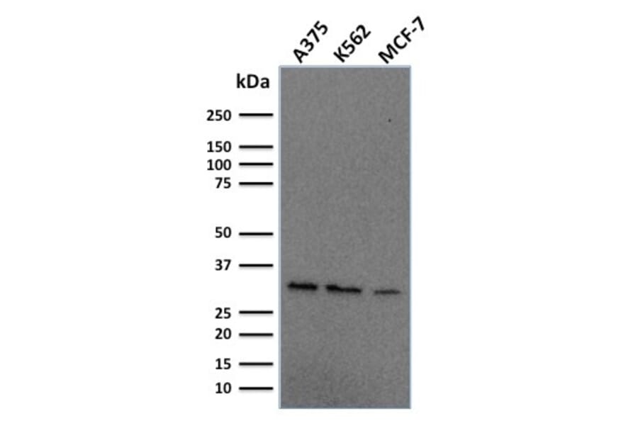 Western Blot - Anti-RPA2 Antibody [RPA2/2106] - BSA and Azide free (A253093) - Antibodies.com