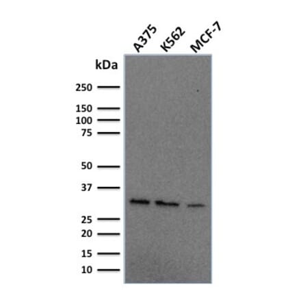 Western Blot - Anti-RPA2 Antibody [RPA2/2106] - BSA and Azide free (A253093) - Antibodies.com