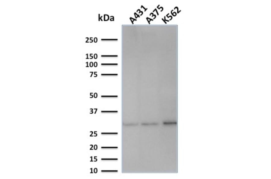 Western Blot - Anti-RPA2 Antibody [SPM316] - BSA and Azide free (A253093) - Antibodies.com