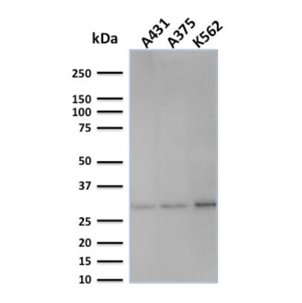 Western Blot - Anti-RPA2 Antibody [SPM316] - BSA and Azide free (A253093) - Antibodies.com