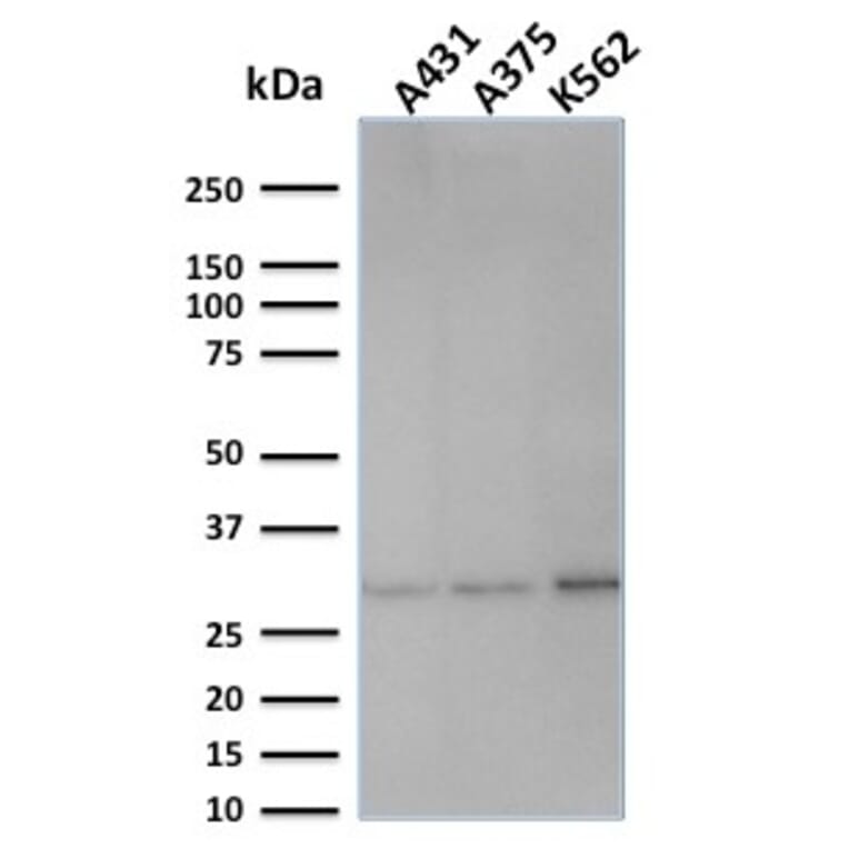 Western Blot - Anti-RPA2 Antibody [SPM316] - BSA and Azide free (A253093) - Antibodies.com