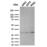 Western Blot - Anti-RPA2 Antibody [SPM316] - BSA and Azide free (A253093) - Antibodies.com