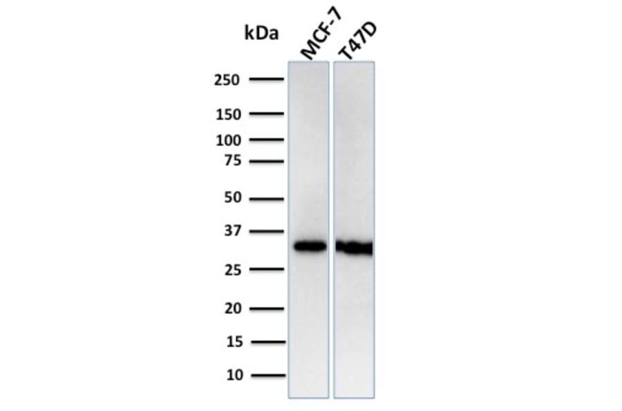 Western Blot - Anti-RPA2 Antibody [RPA2/3140R] - BSA and Azide free (A253094) - Antibodies.com