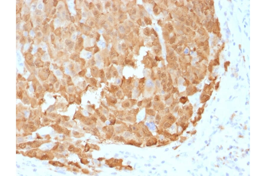Immunohistochemistry - Anti-S100A1 Antibody [S100A1/1942] - BSA and Azide free (A253098) - Antibodies.com