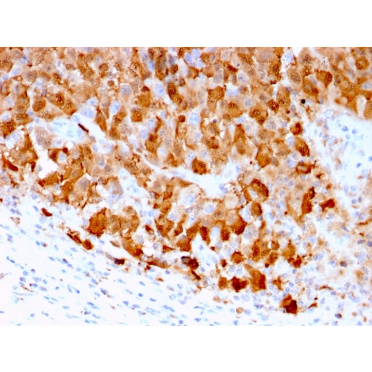 Immunohistochemistry - Anti-S100A1 Antibody [S100A1/1942] - BSA and Azide free (A253098) - Antibodies.com