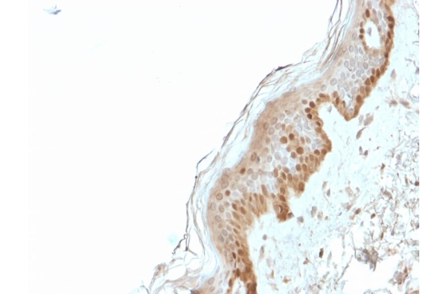 Immunohistochemistry - Anti-S100A2 Antibody [CPTC-S100A2-2] - BSA and Azide free (A253099) - Antibodies.com