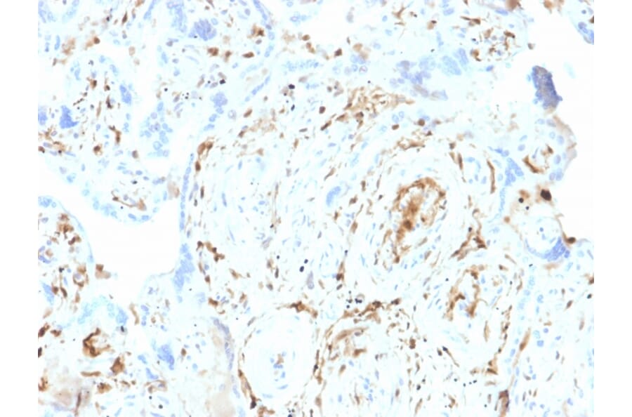 Immunohistochemistry - Anti-S100A2 Antibody [CPTC-S100A2-2] - BSA and Azide free (A253099) - Antibodies.com