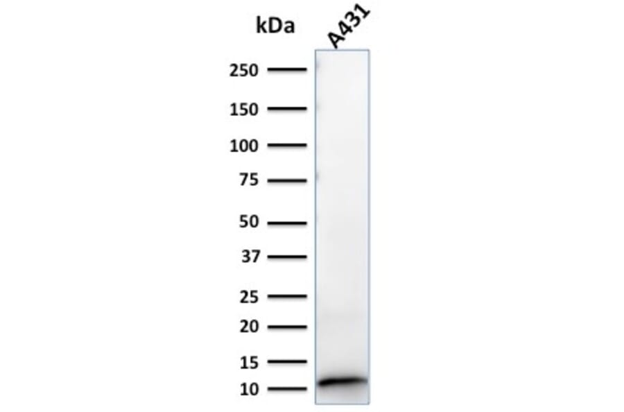 Western Blot - Anti-S100A2 Antibody [CPTC-S100A2-2] - BSA and Azide free (A253099) - Antibodies.com