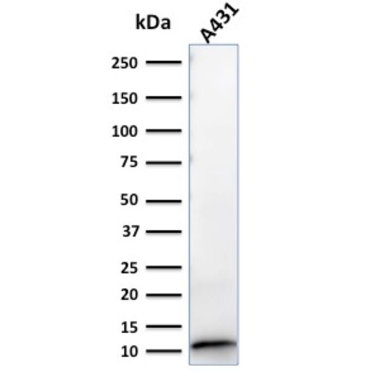 Western Blot - Anti-S100A2 Antibody [CPTC-S100A2-2] - BSA and Azide free (A253099) - Antibodies.com