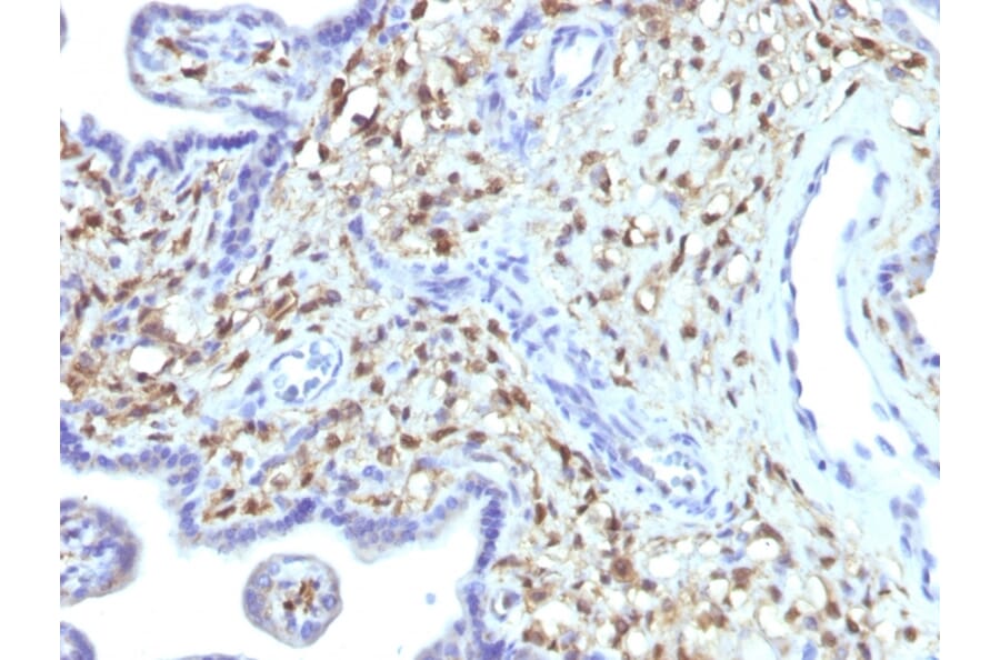 Immunohistochemistry - Anti-S100A4 Antibody [S100A4/1481] - BSA and Azide free (A253100) - Antibodies.com