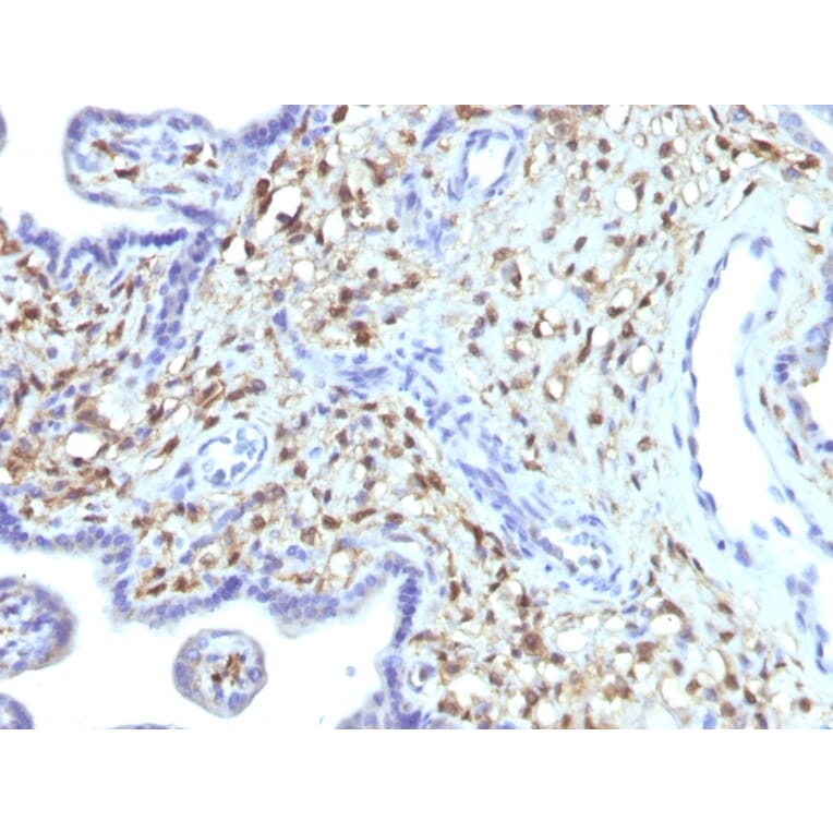 Immunohistochemistry - Anti-S100A4 Antibody [S100A4/1481] - BSA and Azide free (A253100) - Antibodies.com