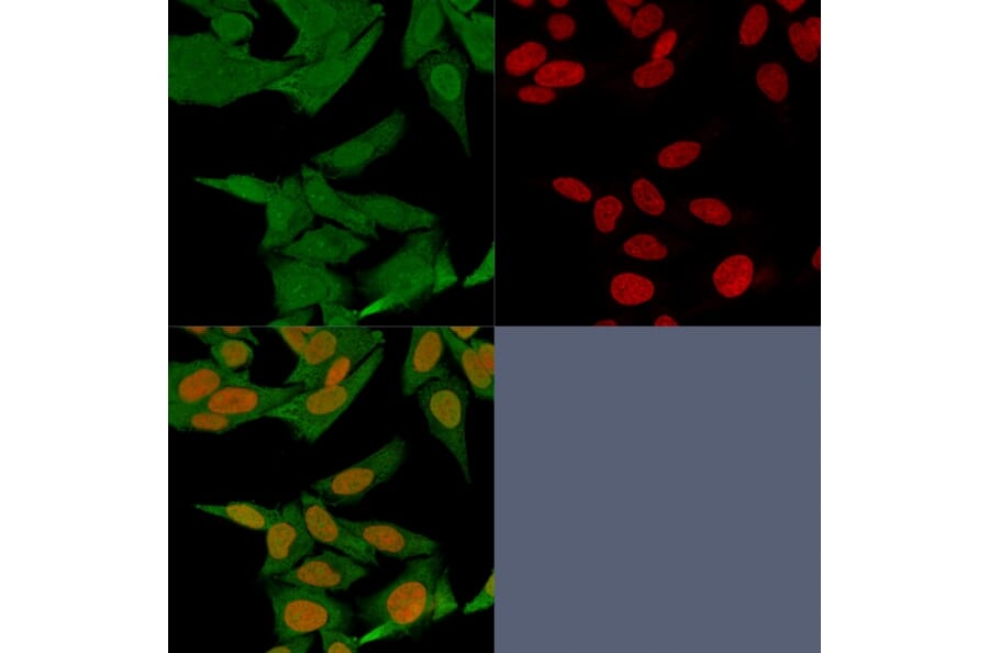 Immunofluorescence - Anti-S100A4 Antibody [S100A4/1481] - BSA and Azide free (A253100) - Antibodies.com