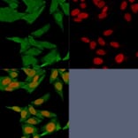 Immunofluorescence - Anti-S100A4 Antibody [S100A4/1481] - BSA and Azide free (A253100) - Antibodies.com