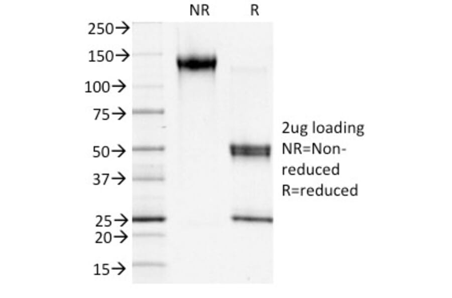 SDS-PAGE - Anti-S100A4 Antibody [S100A4/1481] - BSA and Azide free (A253100) - Antibodies.com