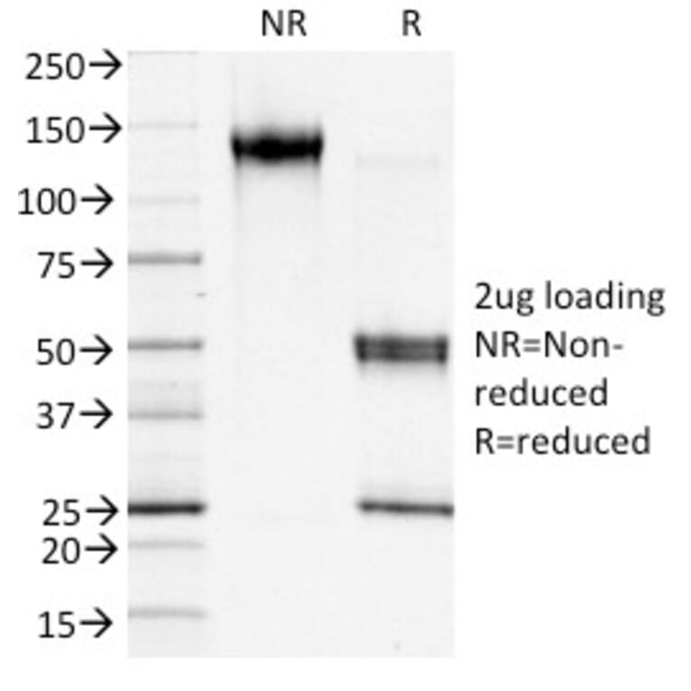 SDS-PAGE - Anti-S100A4 Antibody [S100A4/1481] - BSA and Azide free (A253100) - Antibodies.com