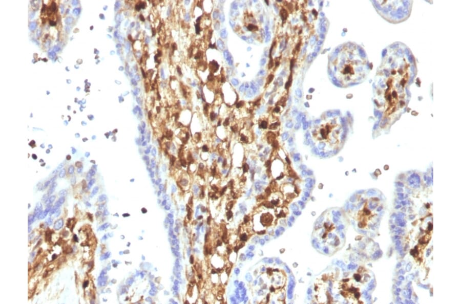 Immunohistochemistry - Anti-S100A4 Antibody [S100A4/1482] - BSA and Azide free (A253101) - Antibodies.com
