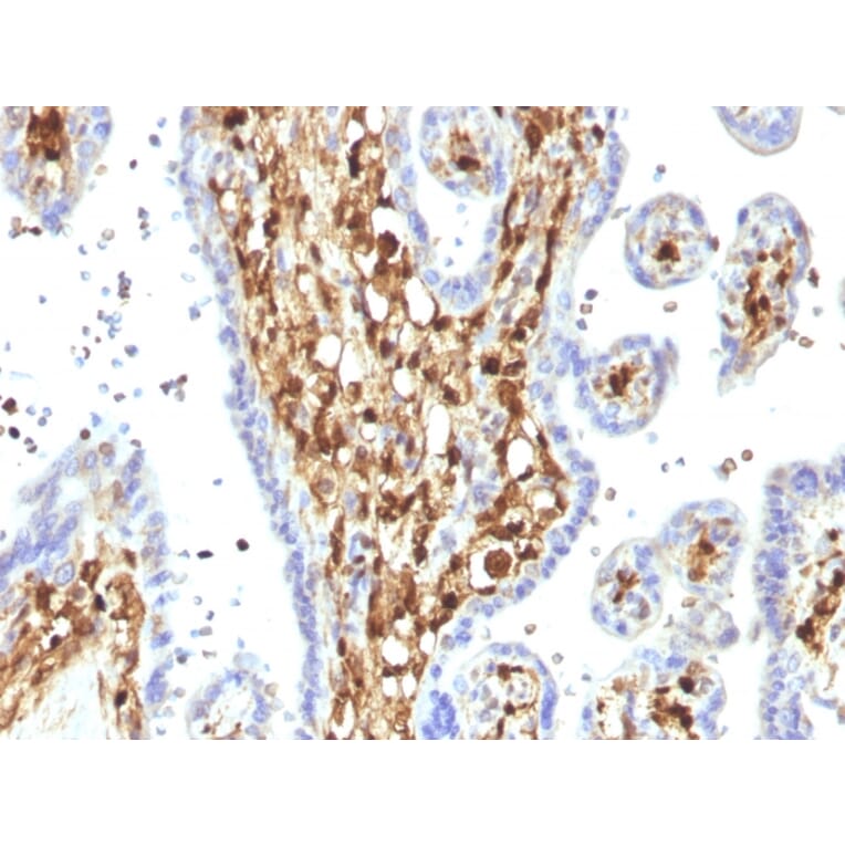 Immunohistochemistry - Anti-S100A4 Antibody [S100A4/1482] - BSA and Azide free (A253101) - Antibodies.com