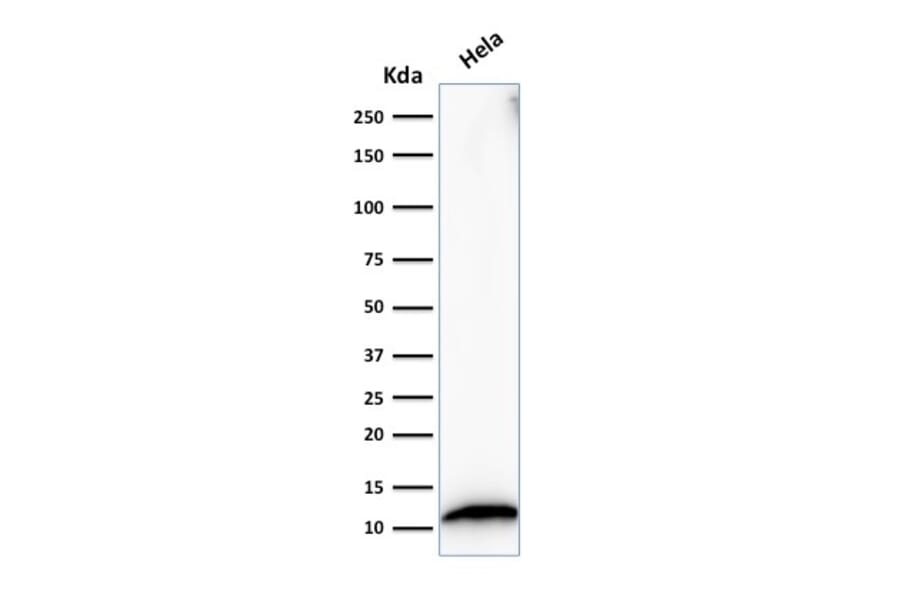 Western Blot - Anti-S100A4 Antibody [S100A4/1482] - BSA and Azide free (A253101) - Antibodies.com