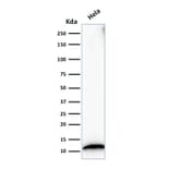 Western Blot - Anti-S100A4 Antibody [S100A4/1482] - BSA and Azide free (A253101) - Antibodies.com