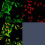Immunofluorescence - Anti-S100A4 Antibody [S100A4/1482] - BSA and Azide free (A253101) - Antibodies.com