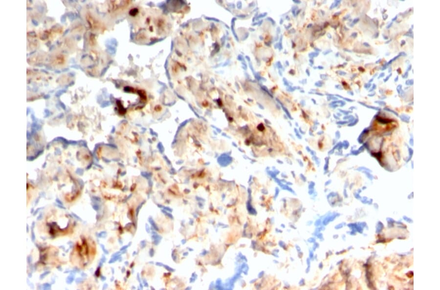 Immunohistochemistry - Anti-S100A4 Antibody [rS100A4/1481] - BSA and Azide free (A253103) - Antibodies.com