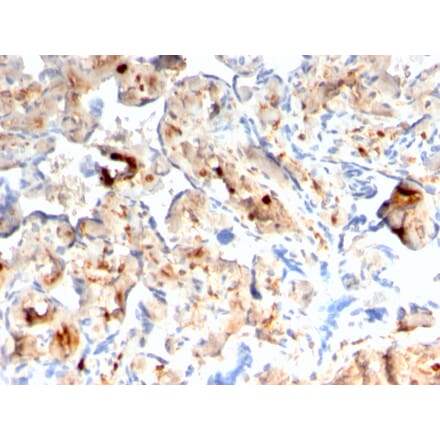 Immunohistochemistry - Anti-S100A4 Antibody [rS100A4/1481] - BSA and Azide free (A253103) - Antibodies.com