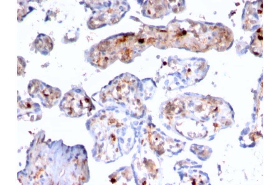 Immunohistochemistry - Anti-S100A4 Antibody [rS100A4/1481] - BSA and Azide free (A253103) - Antibodies.com