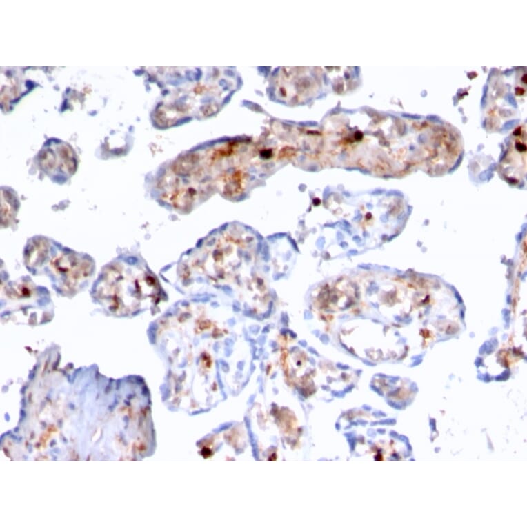 Immunohistochemistry - Anti-S100A4 Antibody [rS100A4/1481] - BSA and Azide free (A253103) - Antibodies.com