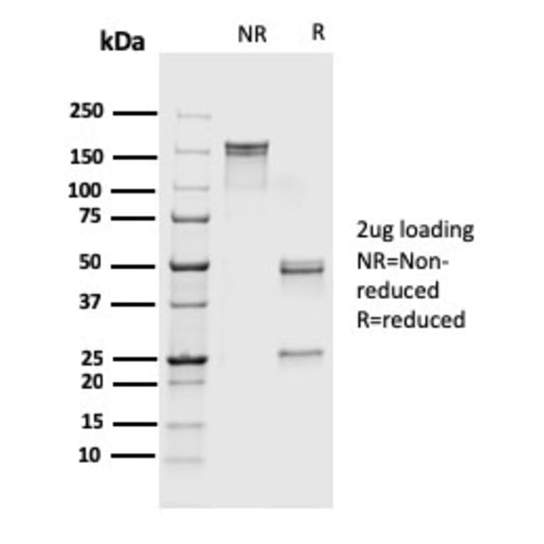 SDS-PAGE - Anti-S100A4 Antibody [rS100A4/1481] - BSA and Azide free (A253103) - Antibodies.com