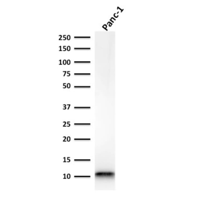 Western Blot - Anti-S100A4 Antibody [rS100A4/1481] - BSA and Azide free (A253103) - Antibodies.com