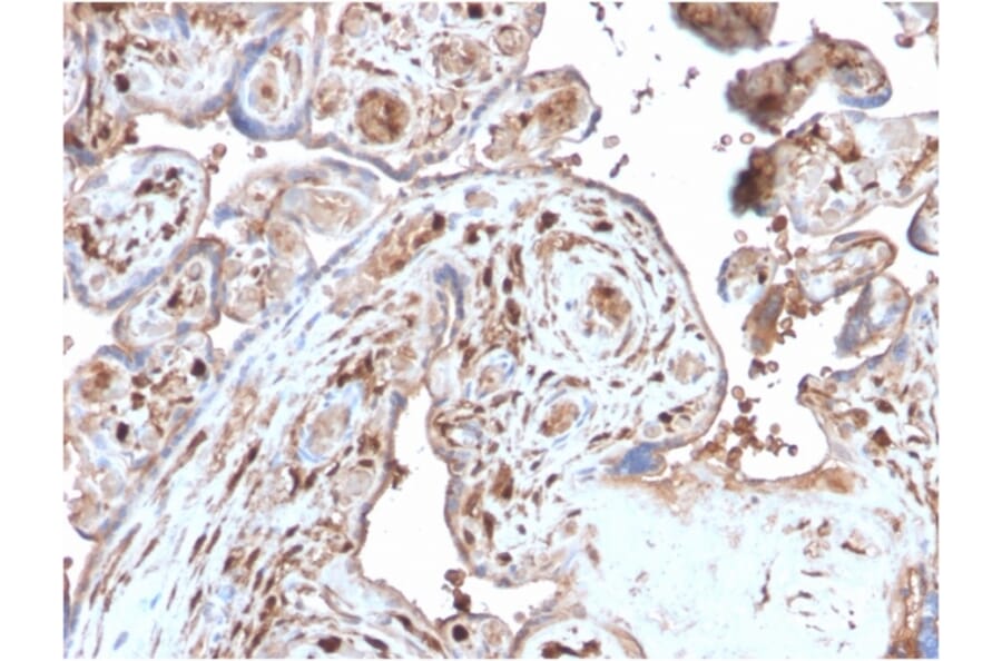 Immunohistochemistry - Anti-S100A4 Antibody [S100A4/2750R] - BSA and Azide free (A253104) - Antibodies.com