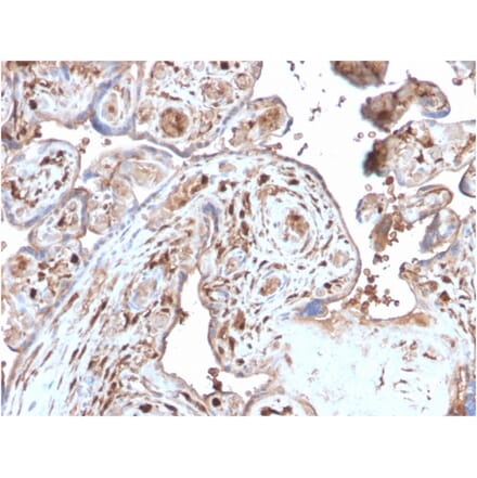 Immunohistochemistry - Anti-S100A4 Antibody [S100A4/2750R] - BSA and Azide free (A253104) - Antibodies.com
