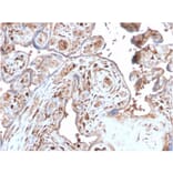 Immunohistochemistry - Anti-S100A4 Antibody [S100A4/2750R] - BSA and Azide free (A253104) - Antibodies.com