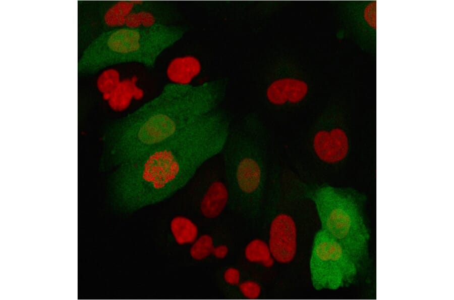 Immunofluorescence - Anti-S100A4 Antibody [S100A4/2750R] - BSA and Azide free (A253104) - Antibodies.com