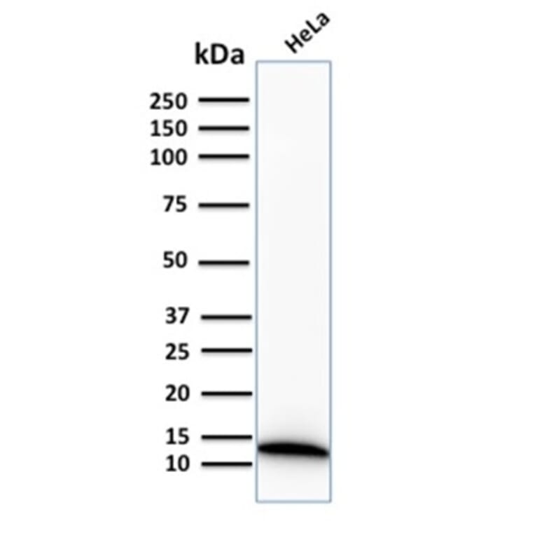 Western Blot - Anti-S100A4 Antibody [S100A4/2750R] - BSA and Azide free (A253104) - Antibodies.com