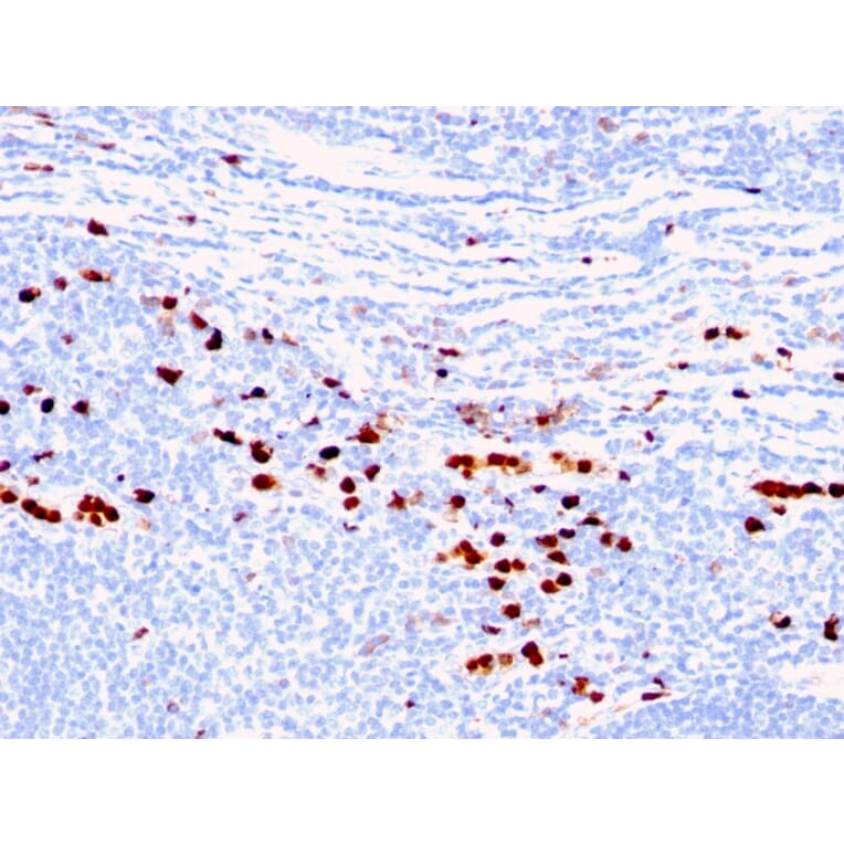 Immunohistochemistry - Anti-Calprotectin Antibody [MAC387] - BSA and Azide free (A253104) - Antibodies.com