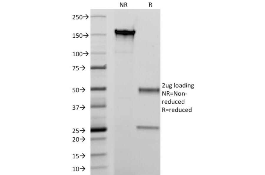 SDS-PAGE - Anti-Calprotectin Antibody [MAC387] - BSA and Azide free (A253105) - Antibodies.com