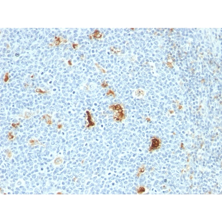Immunohistochemistry - Anti-Macrophage L1 Protein Antibody [SPM281] - BSA and Azide free (A253105) - Antibodies.com