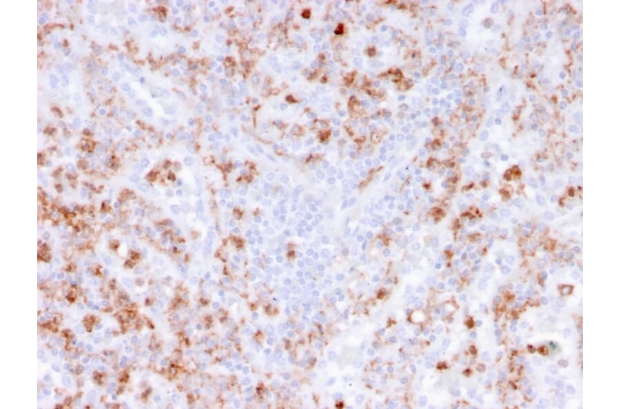 Immunohistochemistry - Anti-Calprotectin Antibody [rMAC3781] - BSA and Azide free (A253107) - Antibodies.com