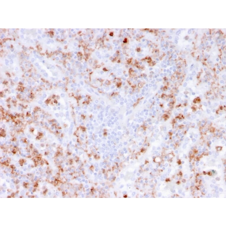 Immunohistochemistry - Anti-Calprotectin Antibody [rMAC3781] - BSA and Azide free (A253107) - Antibodies.com