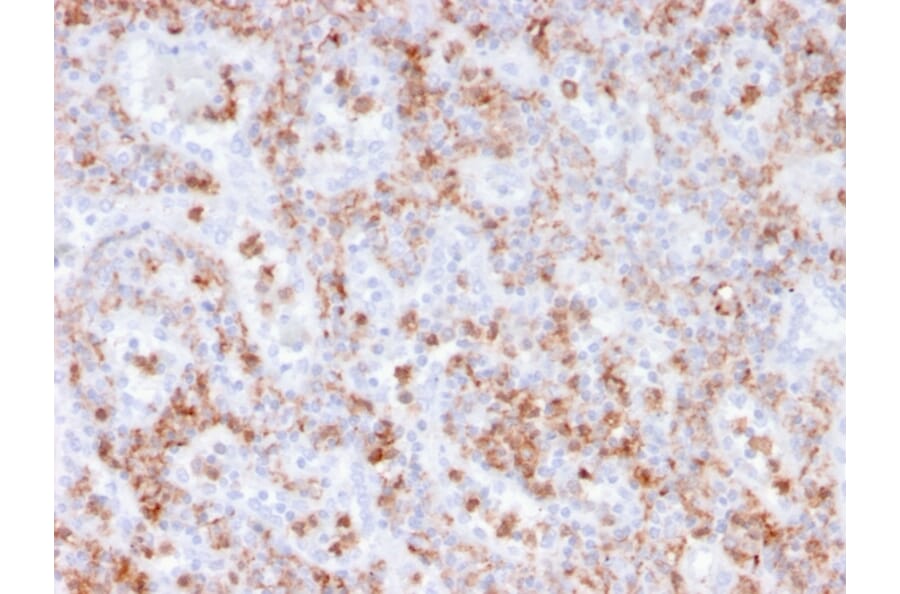 Immunohistochemistry - Anti-Calprotectin Antibody [rMAC3781] - BSA and Azide free (A253106) - Antibodies.com