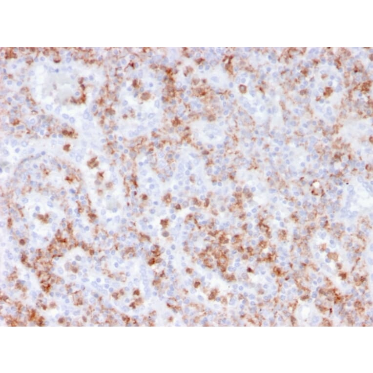 Immunohistochemistry - Anti-Calprotectin Antibody [rMAC3781] - BSA and Azide free (A253106) - Antibodies.com