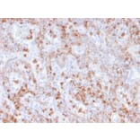 Immunohistochemistry - Anti-Calprotectin Antibody [rMAC3781] - BSA and Azide free (A253106) - Antibodies.com