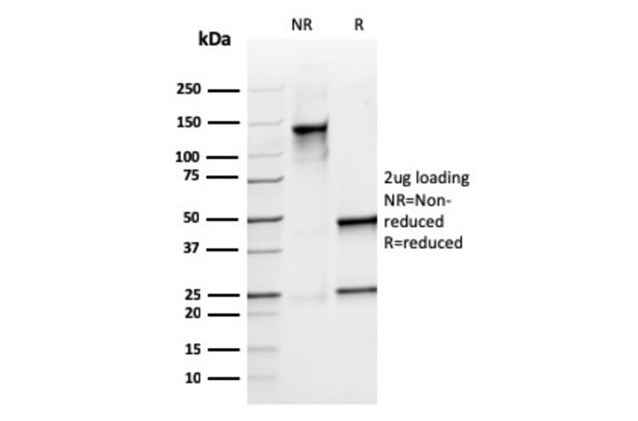 SDS-PAGE - Anti-Calprotectin Antibody [rMAC3781] - BSA and Azide free (A253107) - Antibodies.com