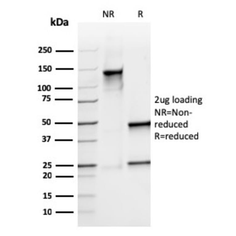 SDS-PAGE - Anti-Calprotectin Antibody [rMAC3781] - BSA and Azide free (A253107) - Antibodies.com