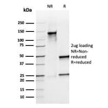 SDS-PAGE - Anti-Calprotectin Antibody [rMAC3781] - BSA and Azide free (A253107) - Antibodies.com